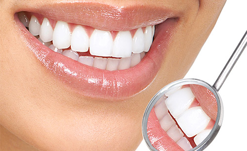 Teeth Whitening